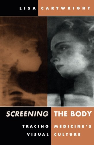 Couverture du livre: Screening the Body - Tracing Medicine's Visual Culture